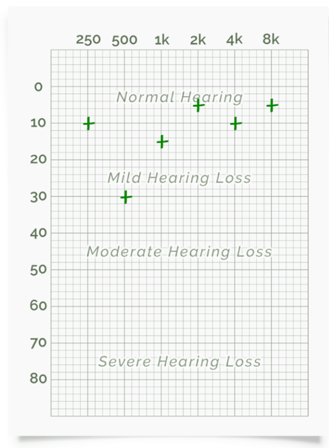 free online hearing test results