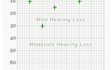 free online hearing test results