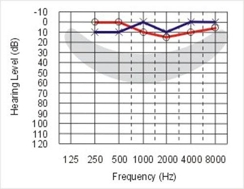 How To Read Your Audiogram Results