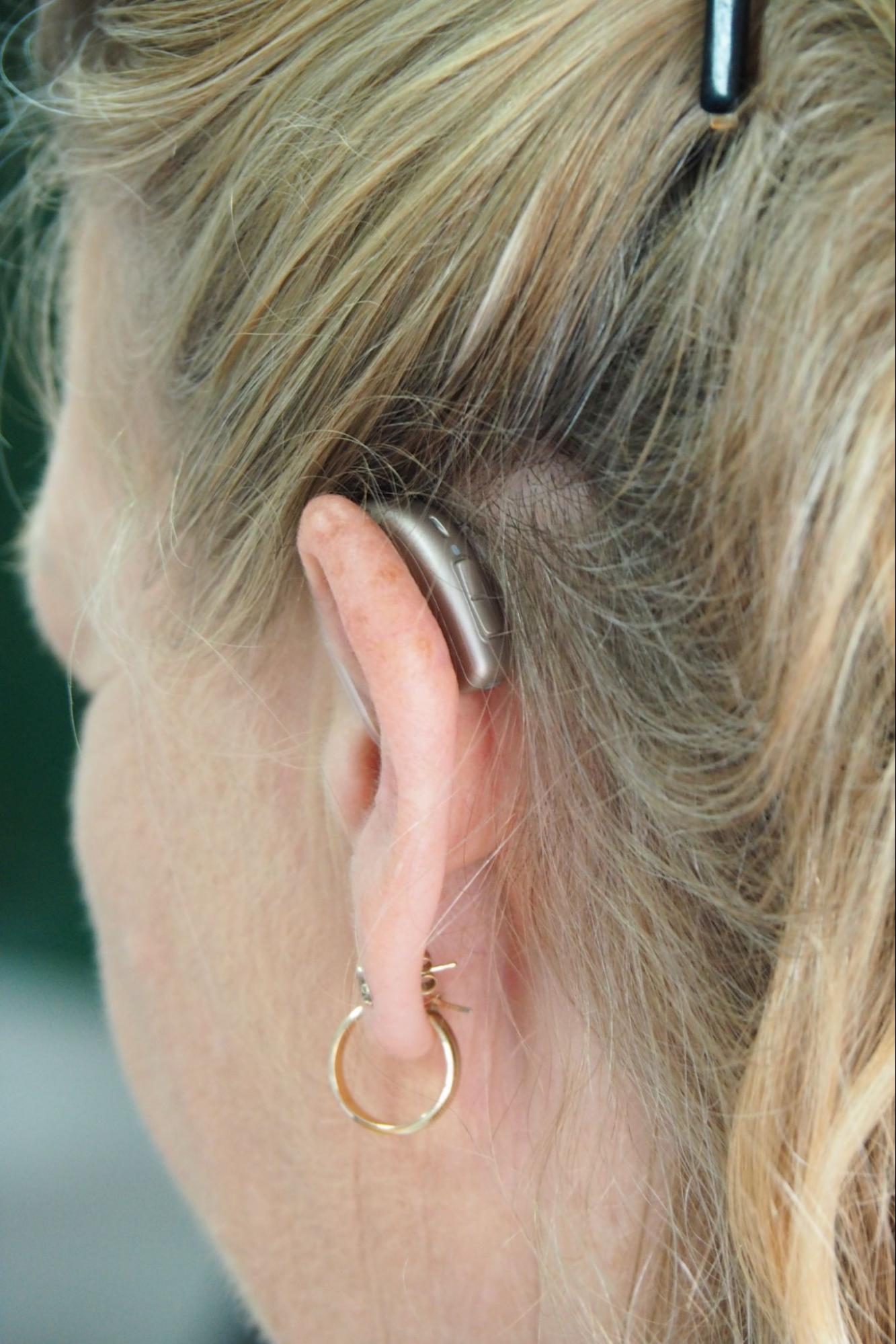 key hearing aid features