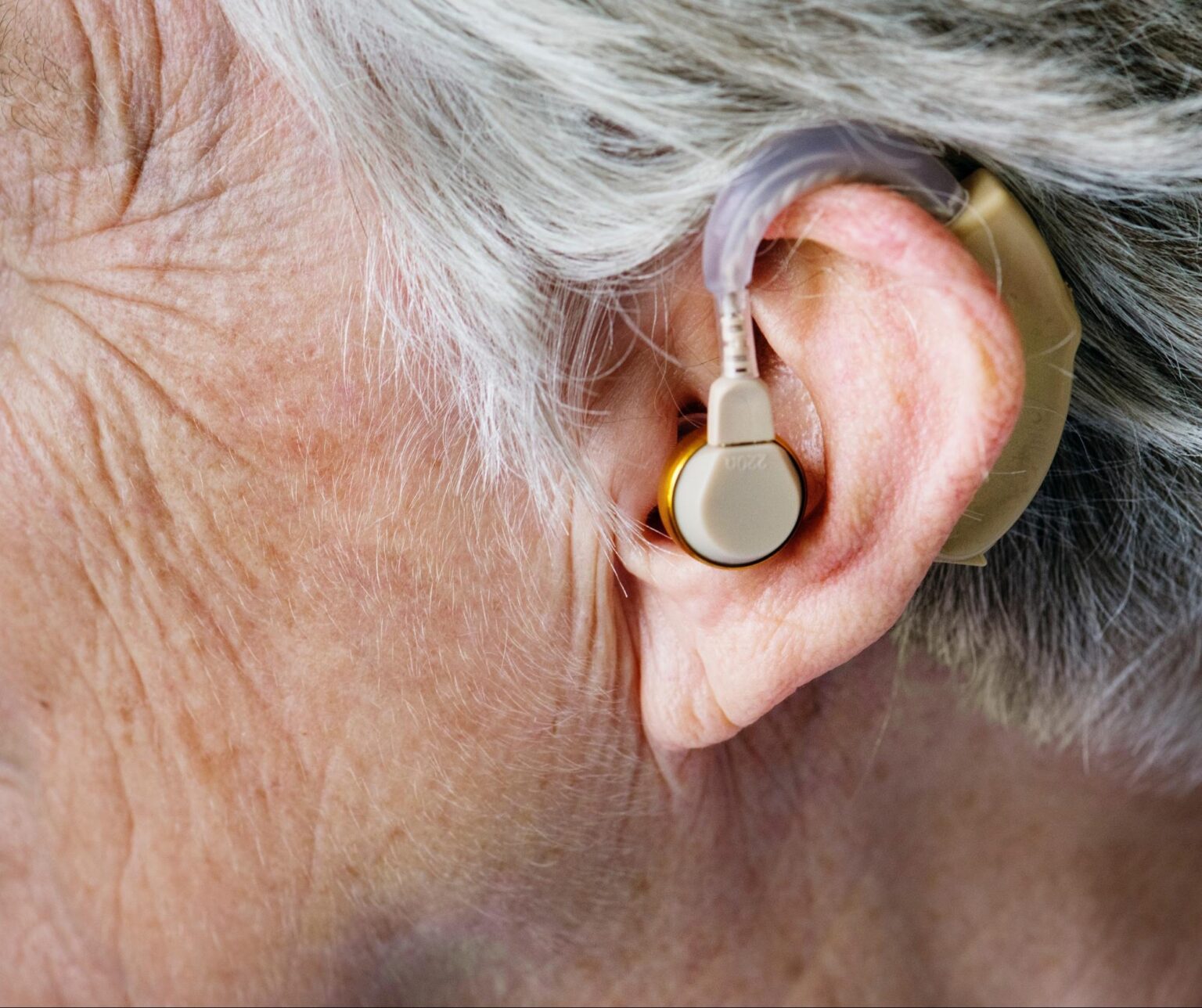 How to Cope with Hearing Aid Feedback Attune
