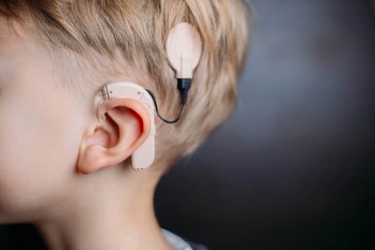 Hearing Aids vs Cochlear Implants Which is Better for You Attune